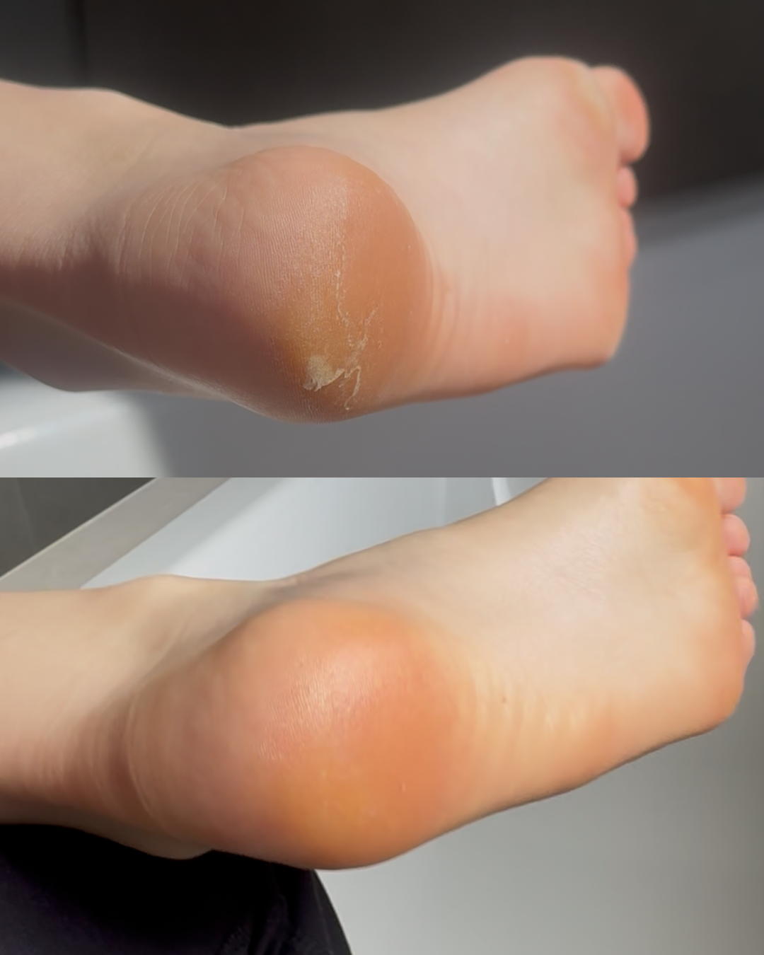 My Glow 2 Silky Foot File